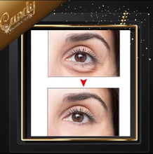 Load image into Gallery viewer, Skin Chemists wrinkle killer anit ageing eye treatment
