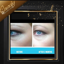 Load image into Gallery viewer, Skin Chemists wrinkle killer anit ageing eye treatment
