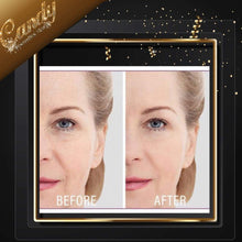 Load image into Gallery viewer, Skin Chemists Instant facelift Rapid lift