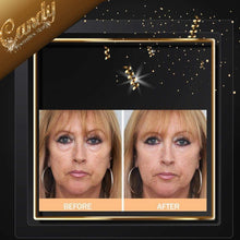Load image into Gallery viewer, Skin Chemists Instant facelift Rapid lift