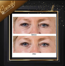 Load image into Gallery viewer, Perricone md Brightening eye serum