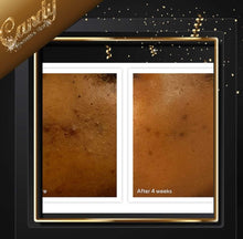 Load image into Gallery viewer, Murad Acne control 30 days kit