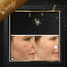 Load image into Gallery viewer, Paula’s Choice AHA 8% Exfoliant ( 15 ml )travel size