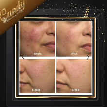 Load image into Gallery viewer, Paula’s Choice AHA 8% Exfoliant ( 15 ml )travel size