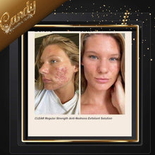 Load image into Gallery viewer, Paula’s Choice AHA 8% Exfoliant ( 15 ml )travel size