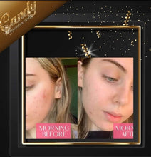 Load image into Gallery viewer, Paula's choice niacinamide 10% Booster