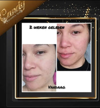 Load image into Gallery viewer, Paula's choice niacinamide 10% Booster