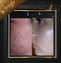 Load image into Gallery viewer, Paula's choice niacinamide 10% Booster