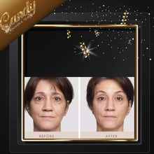 Load image into Gallery viewer, filorga time filler