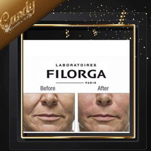 Load image into Gallery viewer, filorga time filler