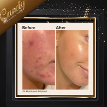 Load image into Gallery viewer, Paula's choice 2%bha liquid exfoliant