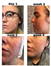 Load image into Gallery viewer, panoxyl acne foaming wash