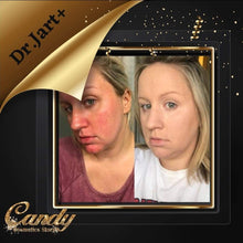 Load image into Gallery viewer, Dr.Jart
Cicapair
Color correcting Treatment