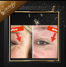 Load image into Gallery viewer, Skin Chemists wrinkle killer anit ageing eye treatment
