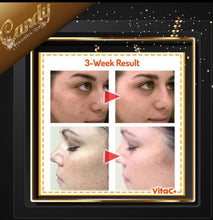 Load image into Gallery viewer, Pericone MD CCC+Ferulic Brightening complex 20%
