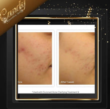 Load image into Gallery viewer, Murad Acne control 30 days kit
