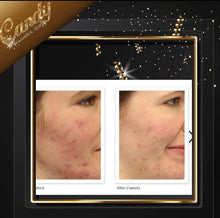 Load image into Gallery viewer, Murad Acne control 30 days kit
